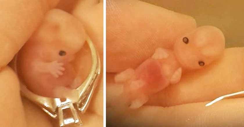 mama viraliza fotos de su bebe que perdio semana  aborto espontaneo